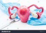 stock-photo-concept-of-gynecology-surgery-d-model-of-female[...].jpg