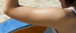 Upperarm.jpg