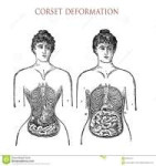 déformation-de-corset-gravure-de-vintage-92307010.jpg