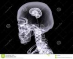 x-ray-small-brain-black-background-41056681[1].jpg