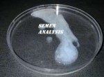 semen analisys.jpg